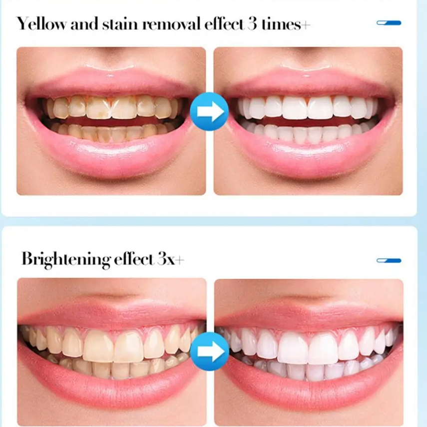 Spumă pentru Albire și Detoxifiere Dentară, CRM, Brighten Whiten, 60 ml [9]