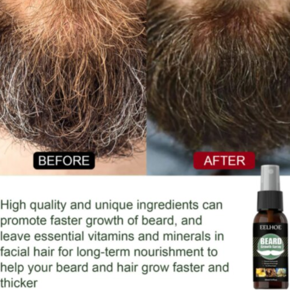 Ulei esential pentru hranire si ingrijire barba si mustata, Eelhoe, CRM, 30 ml [4]