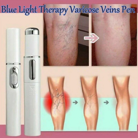 Dispozitiv cu lumina laser pentru tratarea varicelor si acneei, GMO, BlueLight Therapy, alb [7]