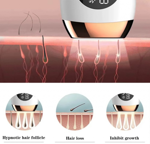 Epilator IPL FLOW 999.999 flash-uri alb – indepartare permanenta a parului [4]