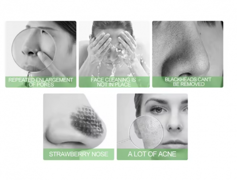 Masca faciala EELHOE cu carbune activ – Peel Off, puncte negre, acnee [3]