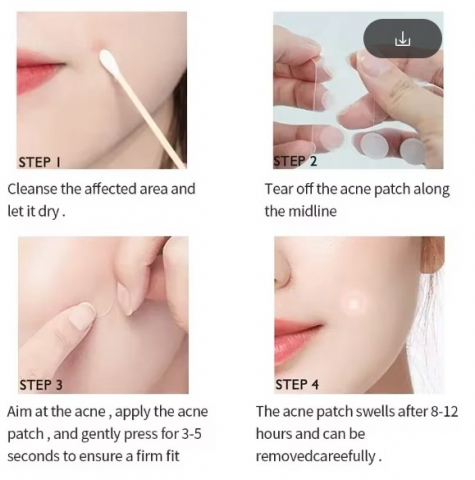 Plasturi invizibili anti-acnee Royal Prestige – Invisible Acne Patches | Tratament Eficient [1]