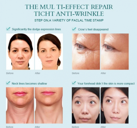 Ser concentrat cu peptide si acid hialuronic, EVNC, Korean aqua, pentru fata si gat, 10 ml [1]