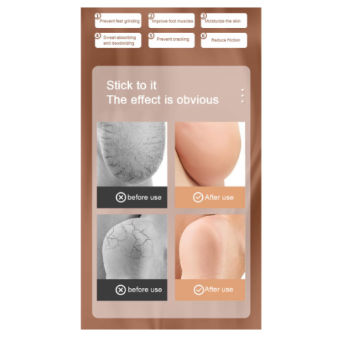 Set 2 protectii calcai cu gel, CRM, mansete elastice silicon, anti-durere si anti-frecare, bej, unisex [4]