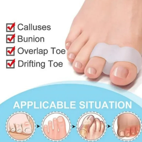 Set 2 Separatoare Degete Picioare, CRM, Silicon Moale, Corector Monturi, Alb, Universal [3]