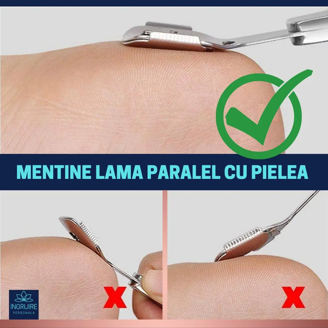 Instrument pentru curatarea calcaielor, calusuri, cu lama interschimbabila, otel inoxidabil [5]