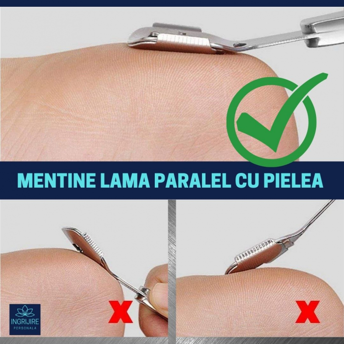 Instrument pentru indepartarea calusurilor cu lama interschimbabila, razuitor si pila, otel inoxidabil [12]
