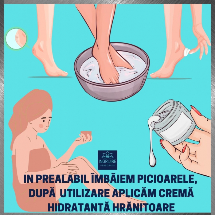 Instrument pentru indepartarea calusurilor cu lama interschimbabila, razuitor si pila, otel inoxidabil [8]