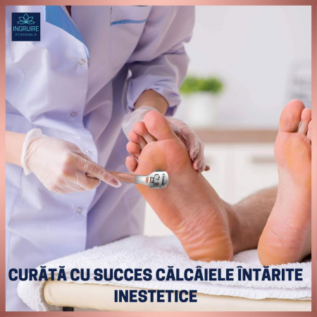 Instrument pentru curatarea calcaielor, calusuri, cu lama interschimbabila, otel inoxidabil [8]