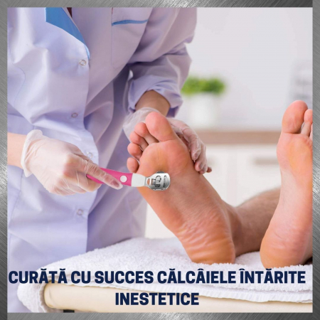 Instrument pentru indepartarea calusurilor cu lama interschimbabila, razuitor si pila, otel inoxidabil [12]