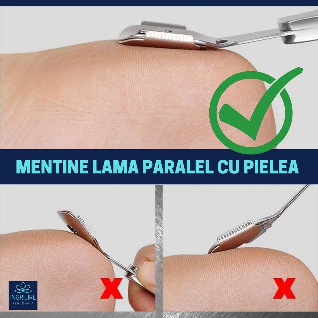 Instrument pentru indepartarea calusurilor cu lama interschimbabila, razuitor si pila, otel inoxidabil [3]