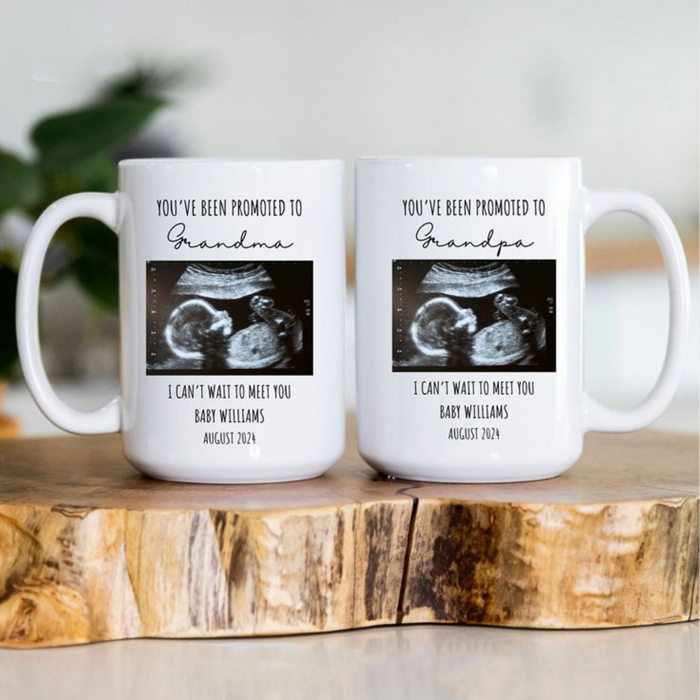 Set de căni personalizate pentru bunic și bunică cu ecografie [1]