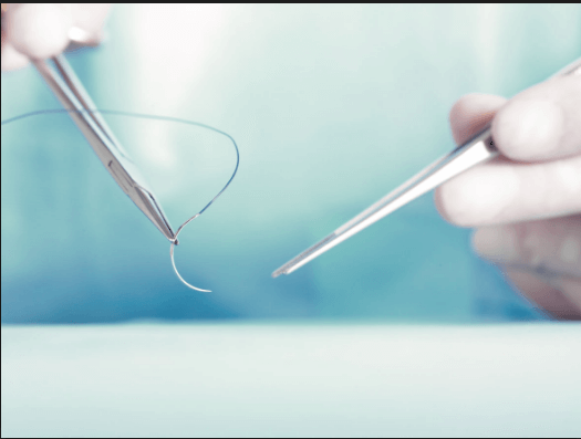 Fire sutura de uz chirurgical B. Braun, etalon pentru inchiderea plagilor