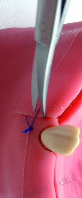 7139 - Foarfece chirurgicala pentru fire de sutura CASTROVIEJO - 11,5 cm [1]