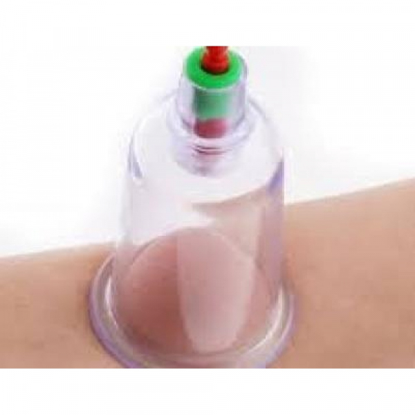 Aparat vacuum pentru terapie cu 24 ventuze medicinale, pompa inclusa [7]