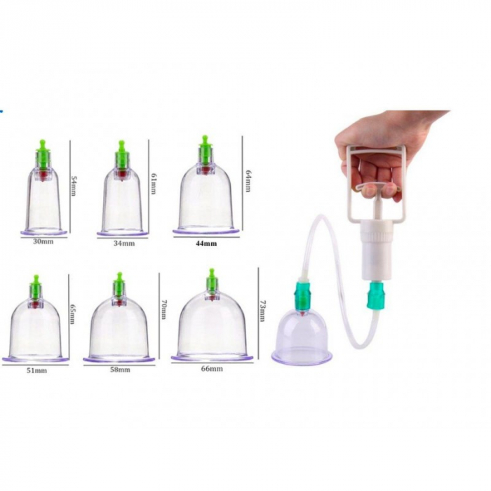Aparat vacuum pentru terapie cu 12 ventuze medicinale, pompa inclusa [2]