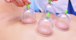 Aparat vacuum pentru terapie cu 12 ventuze medicinale, pompa inclusa [4]