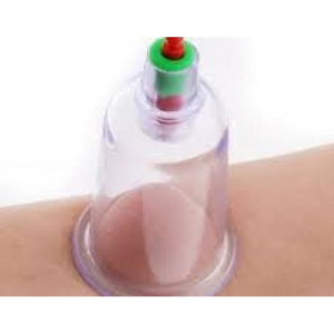 Aparat vacuum pentru terapie cu 24 ventuze medicinale, pompa inclusa [6]