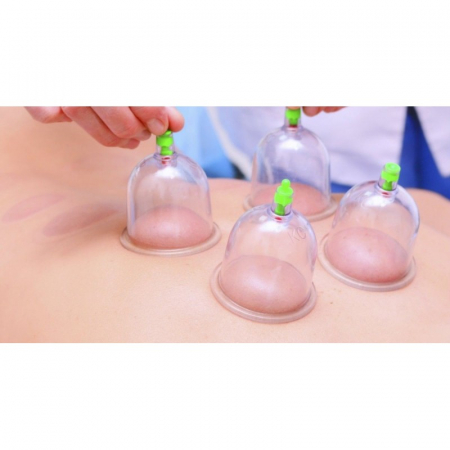 Aparat vacuum pentru terapie cu 12 ventuze medicinale, pompa inclusa [2]