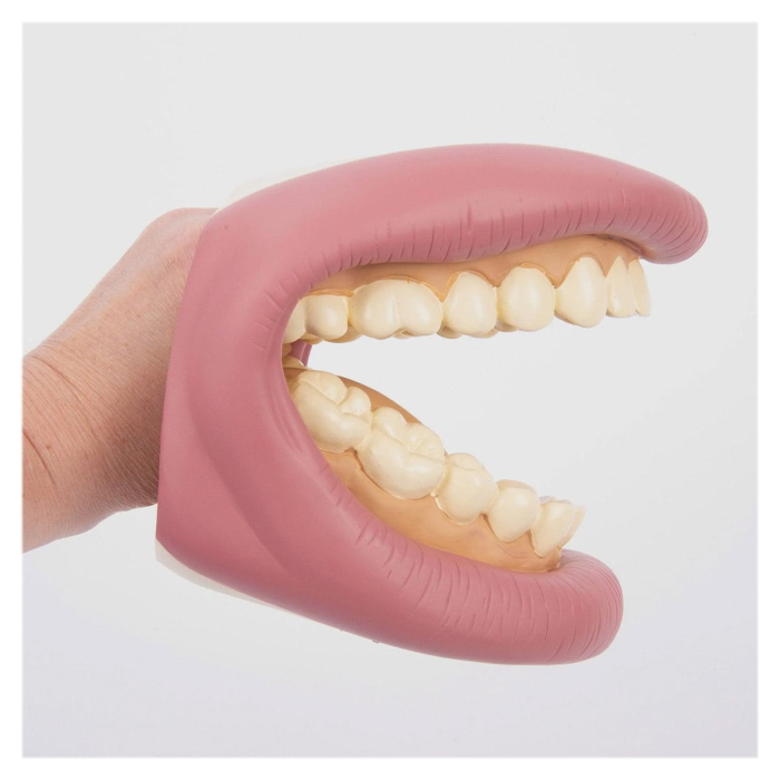 Model dentar demonstrativ, Tickit [4]