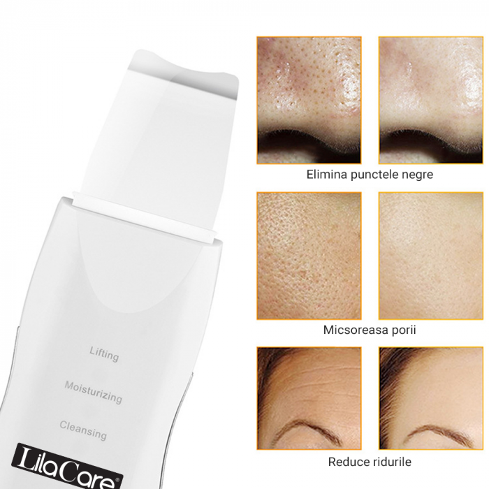 Aparat de curatare faciala cu ultrasunete Lila Care, dispozitiv cu ioni, indepartare puncte negre, hidratare, skin scrubber, peeling, curatare ten, anti rid, anti imbatranire, acumulator, alb [4]
