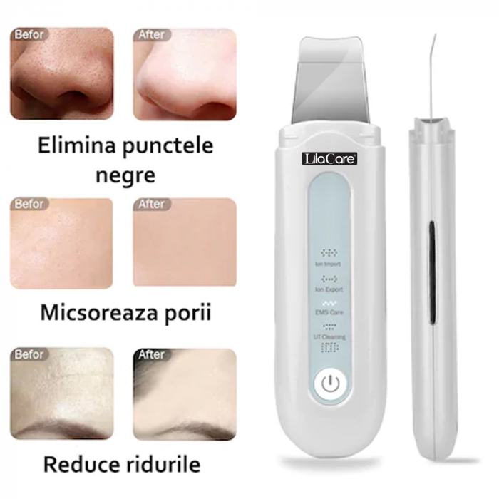 Aparat de curatare faciala si masaj Lila Care, indepartarea punctelor negre, lifting si tonifiere, anti imbatranire, absorbtie nutrienti, alb [6]