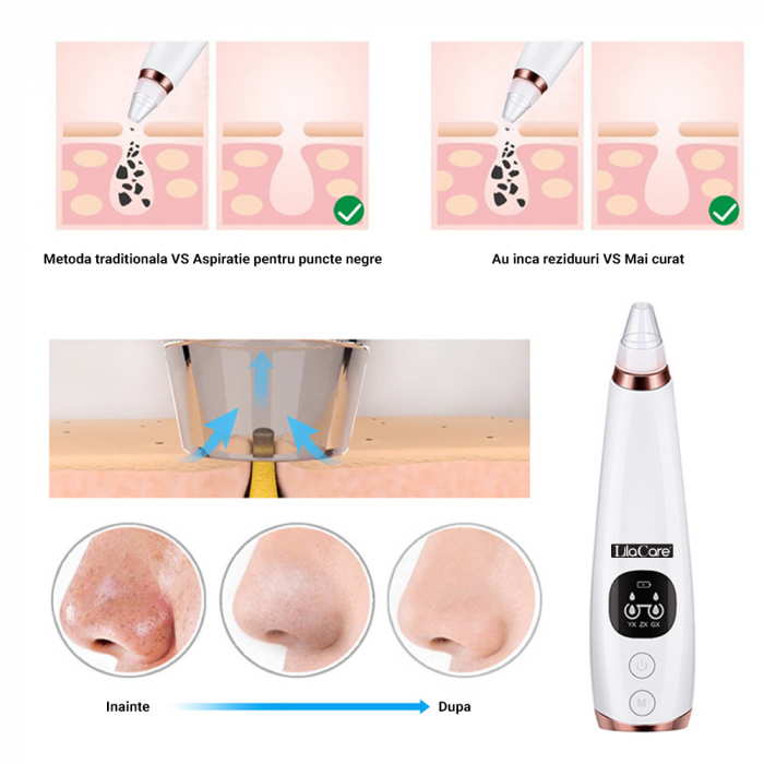 Aspirator facial Lila Care, ingrijire ten, indepartarea punctelor negre, minimizarea porilor, putere de aspirare mare, 6 capete inlocuibile, 7 nivele de rezistenta, portabil, alb [5]