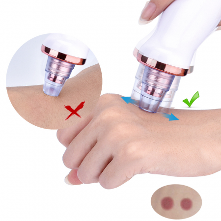 COSMETICA - Aspirator facial Lila Care, ingrijire ten, indepartarea punctelor negre, minimizarea porilor, putere de aspirare mare, 3 nivele de rezistenta, 5 capete inlocuibile, portabil, alb
