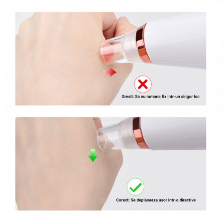 Aspirator facial Lila Care, ingrijire ten, indepartarea punctelor negre, minimizarea porilor, putere de aspirare mare, 6 capete inlocuibile, 7 nivele de rezistenta, portabil, alb [7]