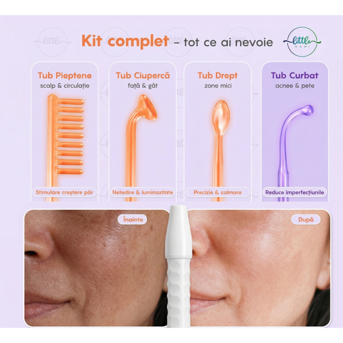 Electroderm, LittleDomi, Tratament cu Frecventa Inalta pentru Acnee, Riduri, Controlul Petelor, Cearcane, Ten, Par Seboreic, Stimulator Scalp, Infrumusetare, Biostimulare Faciala, Lifting, Alb [2]
