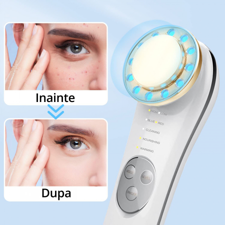 Dispozitiv Tratament si Ingrijire Faciala 5 in 1, LittleDomi, LED, Mezoterapie, Fototerapie, Lifting, Vibratii EMS, Anti-rid, Microcurent, Masaj Facial, Alb&Auriu [3]