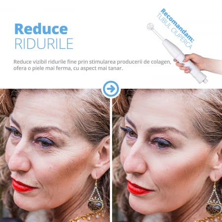 Electroderm, LittleDomi, Tratament cu Frecventa Inalta pentru Acnee, Riduri, Controlul Petelor, Cearcane, Ten, Par Seboreic, Stimulator Scalp, Infrumusetare, Biostimulare Faciala, Lifting, Alb [4]