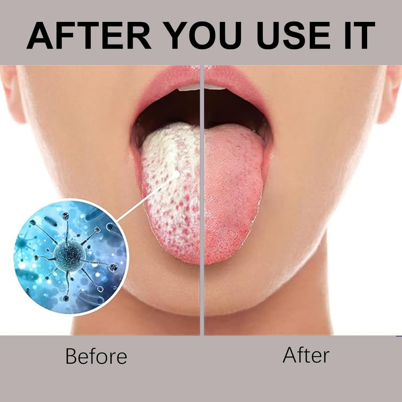 Curățător de Limbă din Oțel Inoxidabil Medicinal – Igienă Orală Premium [7]