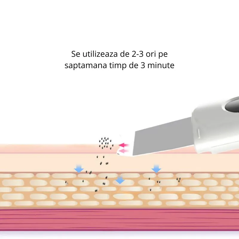 Aparat de peeling ultrasonic pentru fata [7]