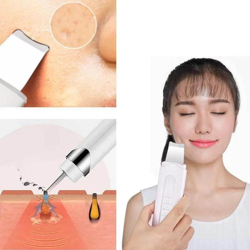 Aparat de peeling ultrasonic pentru fata [6]
