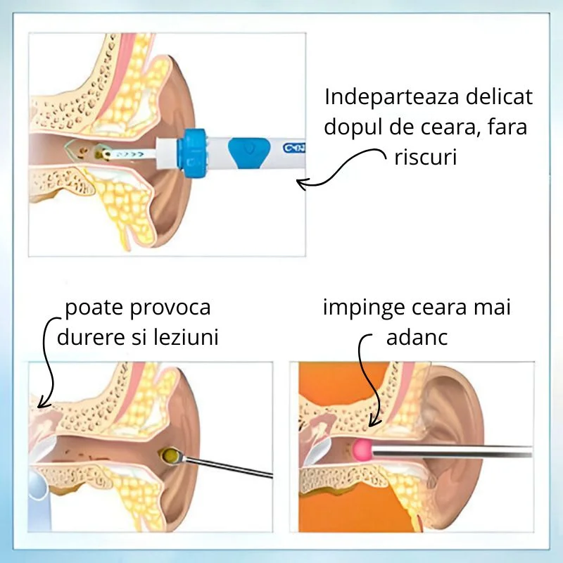 Dispozitiv electric curatarea urechilor [8]