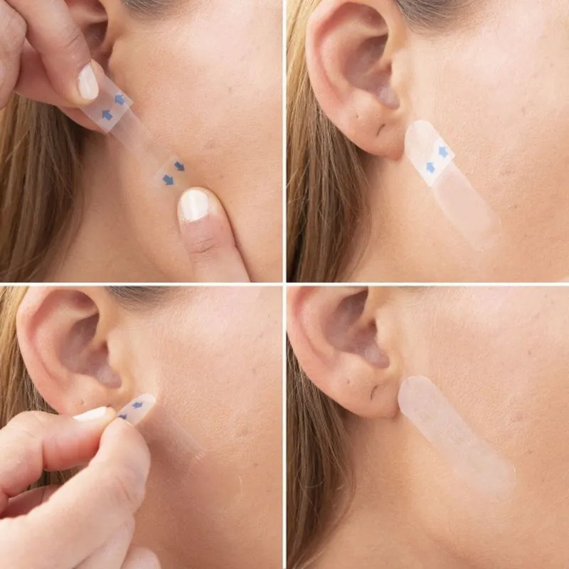 Set 40 Plasturi Invizibili pentru Lifting Facial [2]