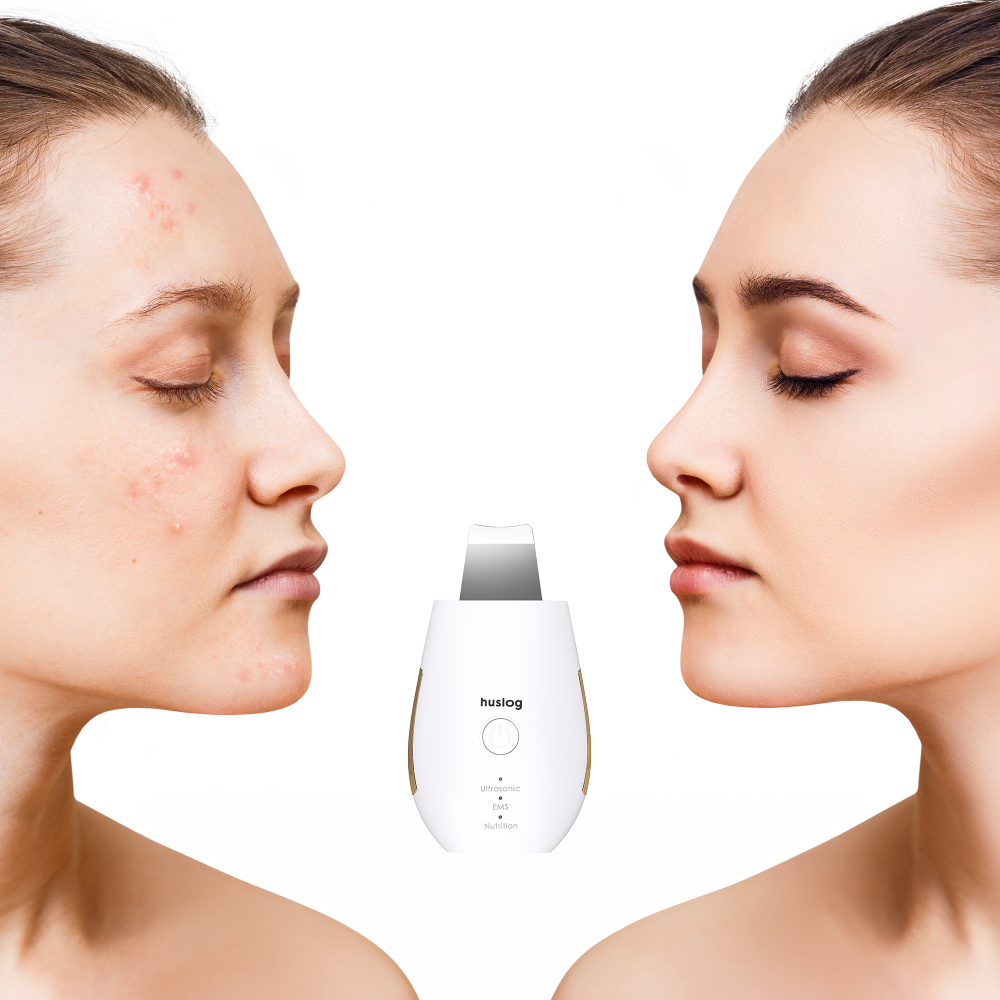 Aparat curatare piele, Huslog skin purifier BE-100224 [6]