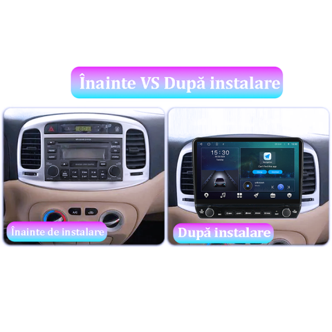 Navigatie dedicata Hyundai ACCENT 2006-2011 Tesla cu butoane rotative model 2024, 4GB RAM 64GB ROM, Procesor Quadcore, Android 14, Display QLED 10", DSP, Carplay&Android Auto [5]