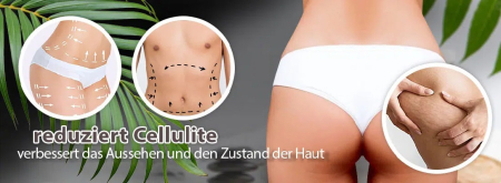 Medivon Cushy aparat masaj corporal reglabil tip ventuza cu infrarosu anticelulitic, relaxare musculara, antistress [3]
