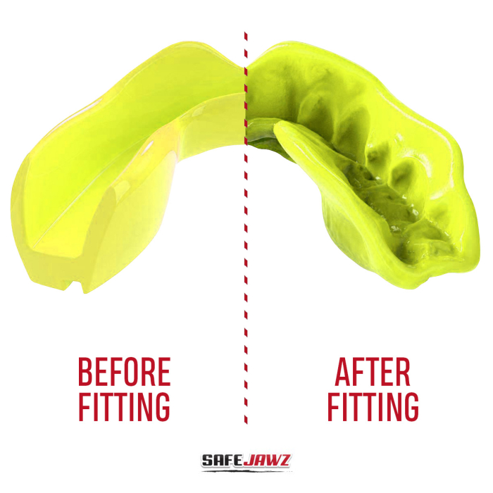 Mouth guard “Intro Fluro” - yellow, junior [2]