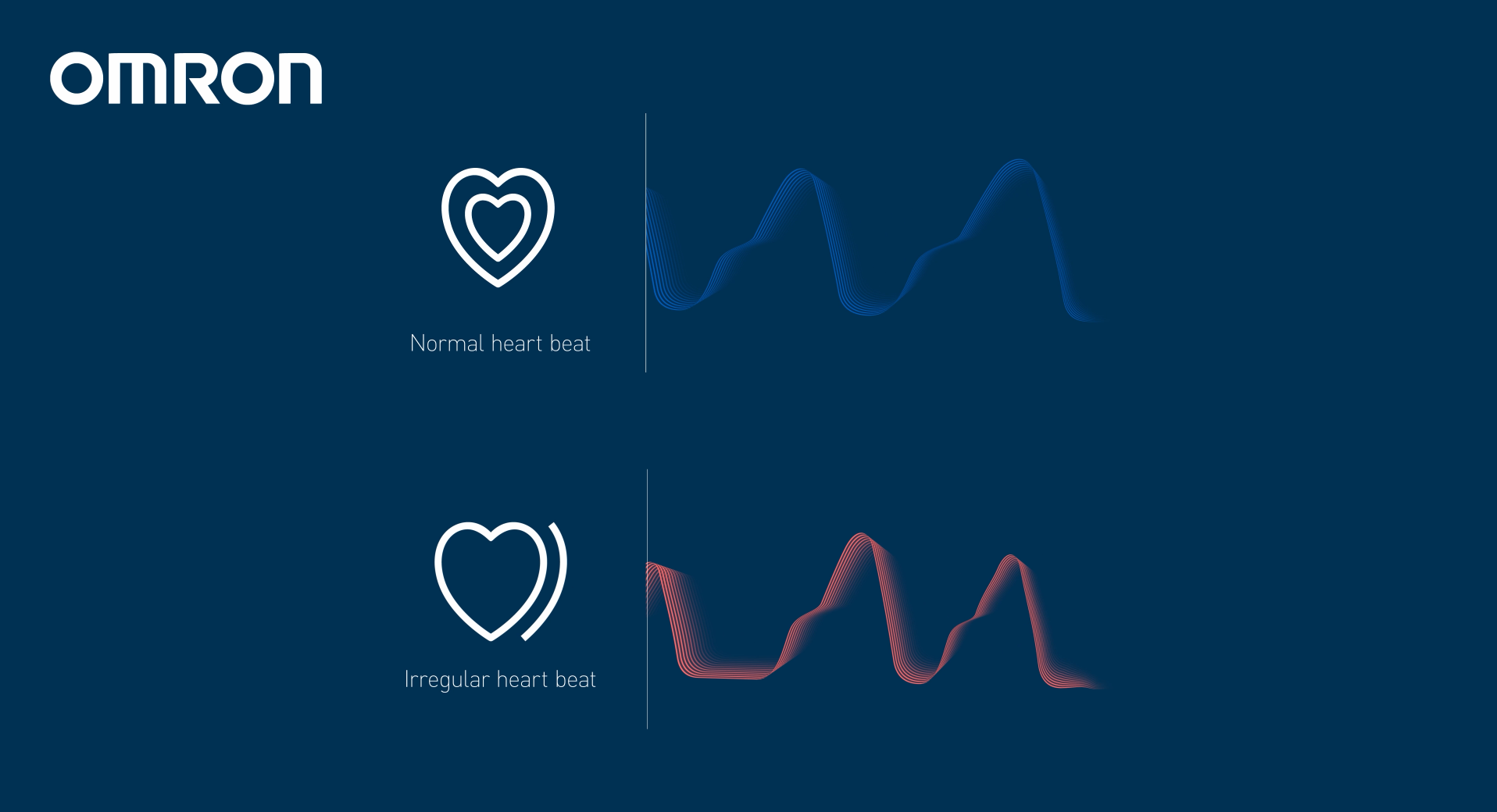 tensiometru-OMRON-X7-Smart-AFib-HEM-7380T1-EOSL-puls-normal-neregulat-afib
