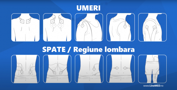 Electrostimulator muscular Omron HeatTens, TENS + HEAT (terapie prin caldura), baterie reincarcabila, pentru ameliorarea durerii articulare si musculare [9]