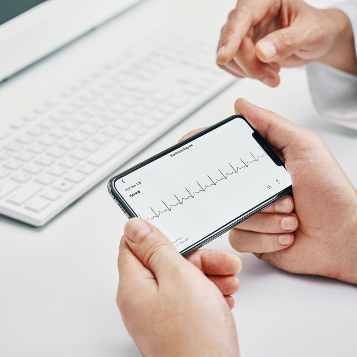 Omron Complete - Tensiometru automat pentru brat + ECG, validat clinic, functie AFIB, fabricat in Japonia [7]