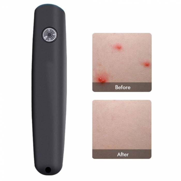 Intepatura de paianjen Intepaturi de insecte Intepatura de tantar taun  Intepaturi de insecte tratament Intepatura de viespe albina Creme pentru muscaturi de insecte Creme pentru intepatura de tantari [8]