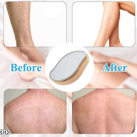 aparat de epilat facial aparat de epilat mustata epilator care smulge parul aparat de epilat emag epilare mustata cu epilatorul produse epilare faciala emag epilatoare reducere mini epilator [19]