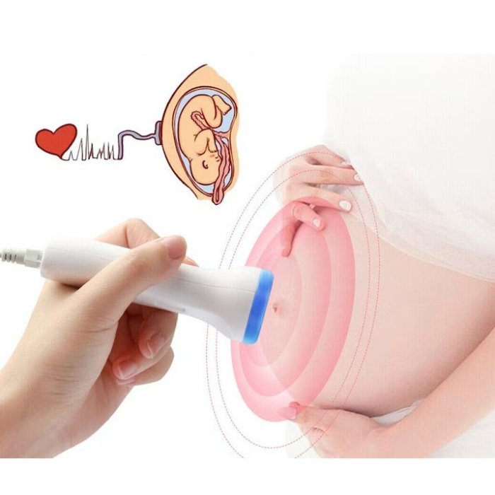 Monitor Fetal Doppler, , Monitorizare Sarcina, Ritm Cardiac, Ecran LCD 4.5 cm, 2 x Baterii AA (neincluse), Portabil, din ABS, 12.8 x 9.6 x 3 cm, Utilizare de la 9 Saptamani, Albastru [3]