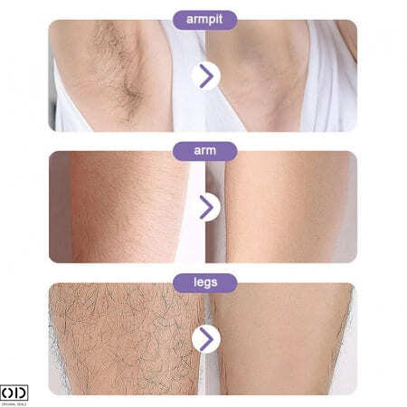 aparat de epilat facial aparat de epilat mustata epilator care smulge parul aparat de epilat emag epilare mustata cu epilatorul produse epilare faciala emag epilatoare reducere mini epilator [4]