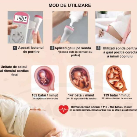 Monitor Fetal Doppler ORIGINAL DEALS, Ecran LCD 4.5 cm, Sonda 3 MHz, Portabil, 2 x AA Neincluse [5]