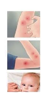 Stick pentru Calmarea Pielii dupa Intepaturile de Tantari, Albine, Viespi, Meduze, pentru Copii, Protectie Naturala cu Extract de Eucalipt, Roll On 14g, Unisex [1]